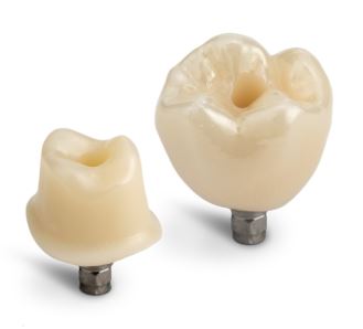 CEREC Cercon 4D Zirconia: Strength meets esthetics chairside | Dentsply ...